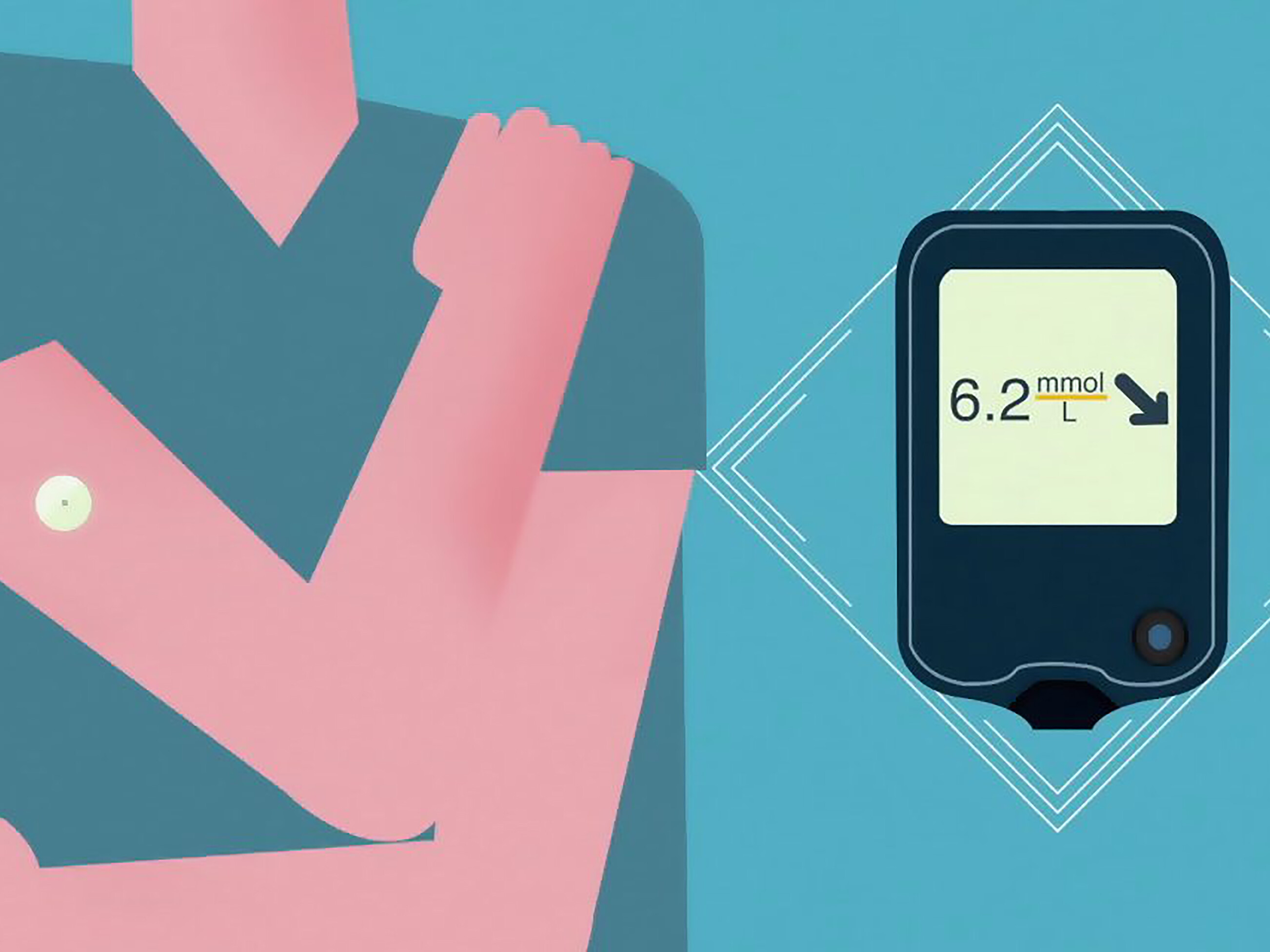Lecteur de glucose en continu