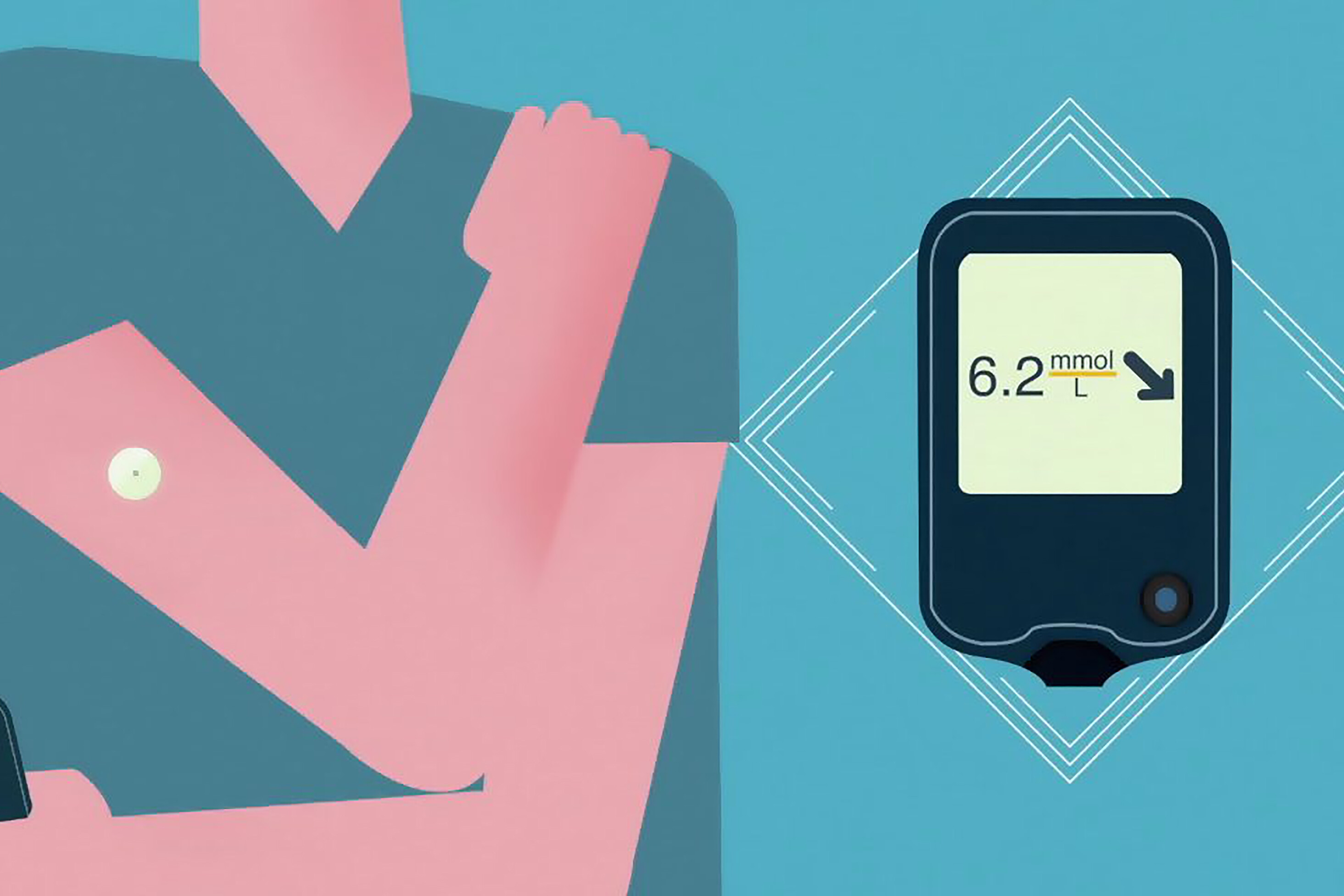 Lecteur de glucose en continu