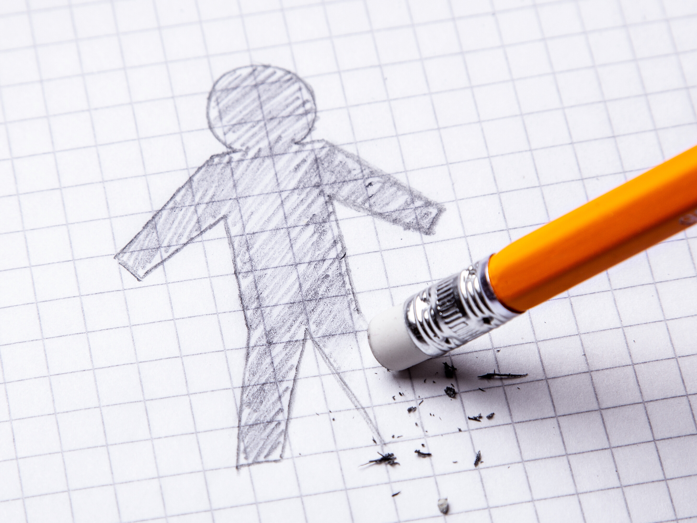 Amputation